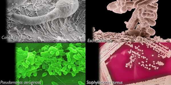 Candida Albicans, Pseudomonas aeruginosa, Escherichia coli and Staphylococcus aureus